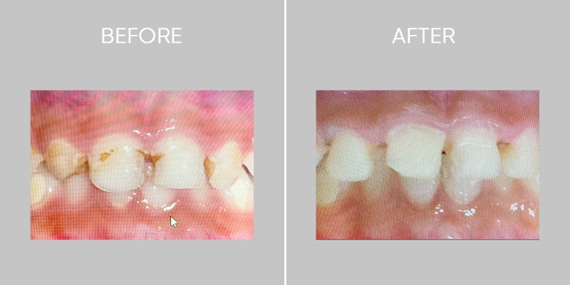 Dent O Clock Treatments