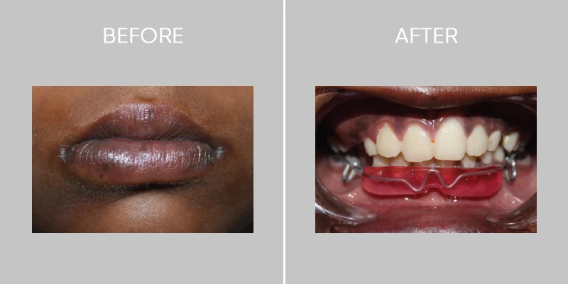Dent O Clock Treatments
