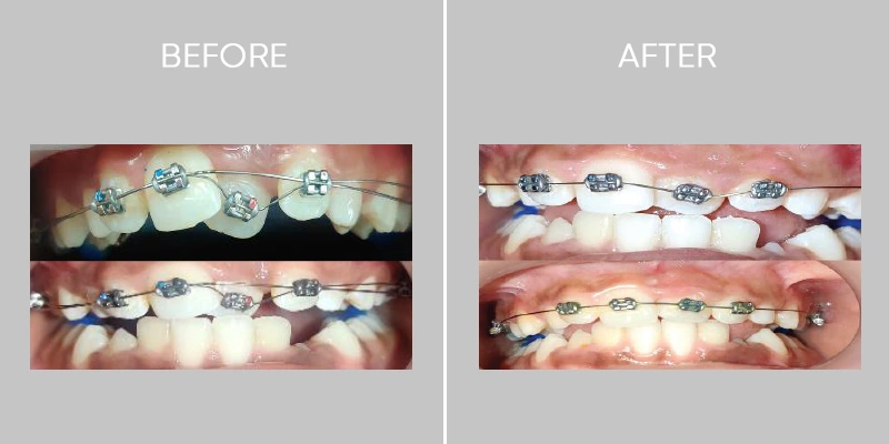 Dent O Clock Treatments
