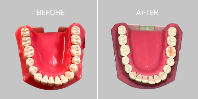 Dent O Clock Treatments