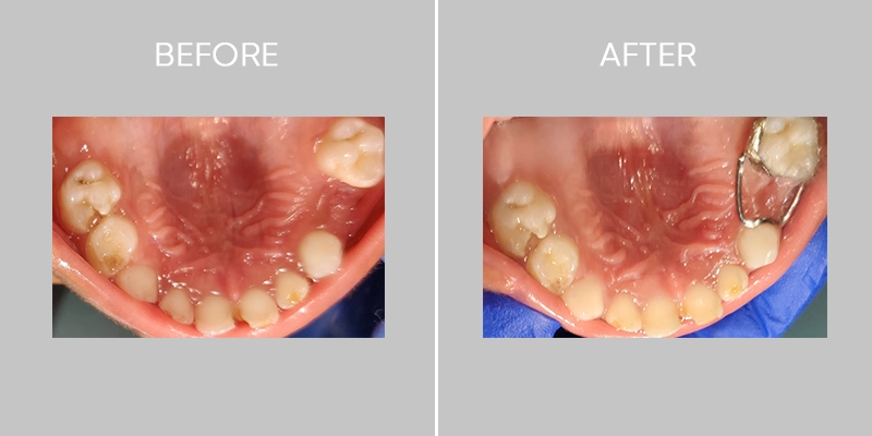 Dent O Clock Treatments