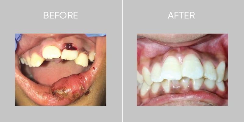 Dent O Clock Treatments