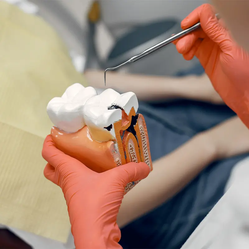 Dent O Clock Treatments