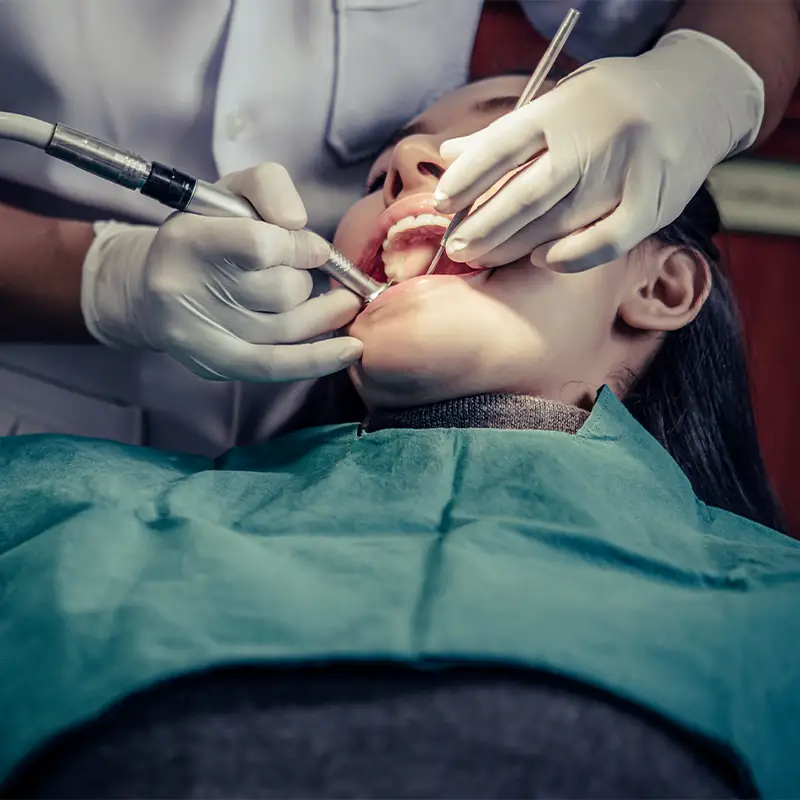 Dent O Clock Treatments